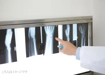 【埼玉県内×整形外科】高額★週5日最大2200万円のご提示可！手術なしで外来に専念！高待遇かつプライベートも大切にできる環境です◎